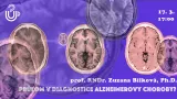 Kavárna Universitas: Průlom v diagnostice Alzheimerovy choroby?